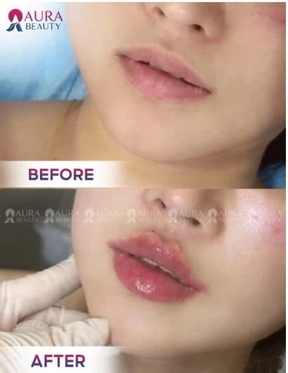 Kết quả phun môi tại Thẩm mỹ viện Aura 