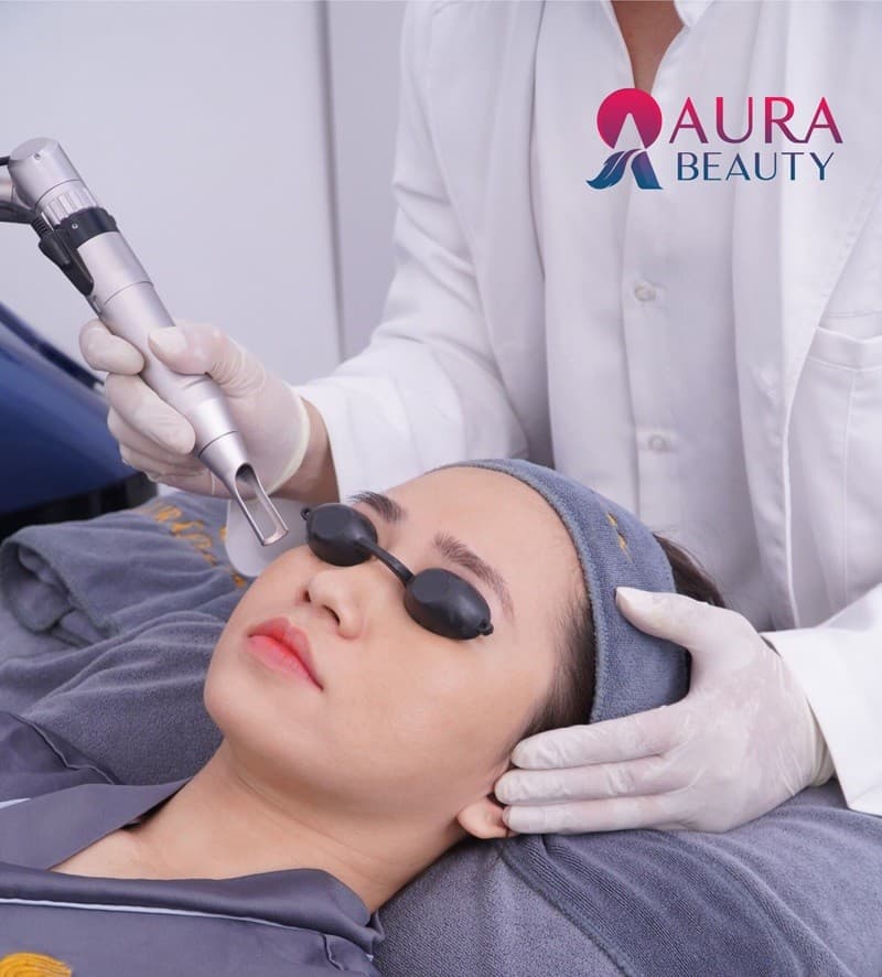 Bắn laser trị nám có tốt không? Những lưu ý khi điều trị