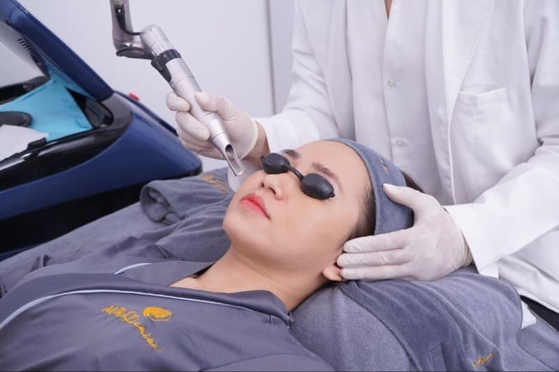 Bật mí các cách trị nám da mặt lâu năm có thể bạn chưa biết