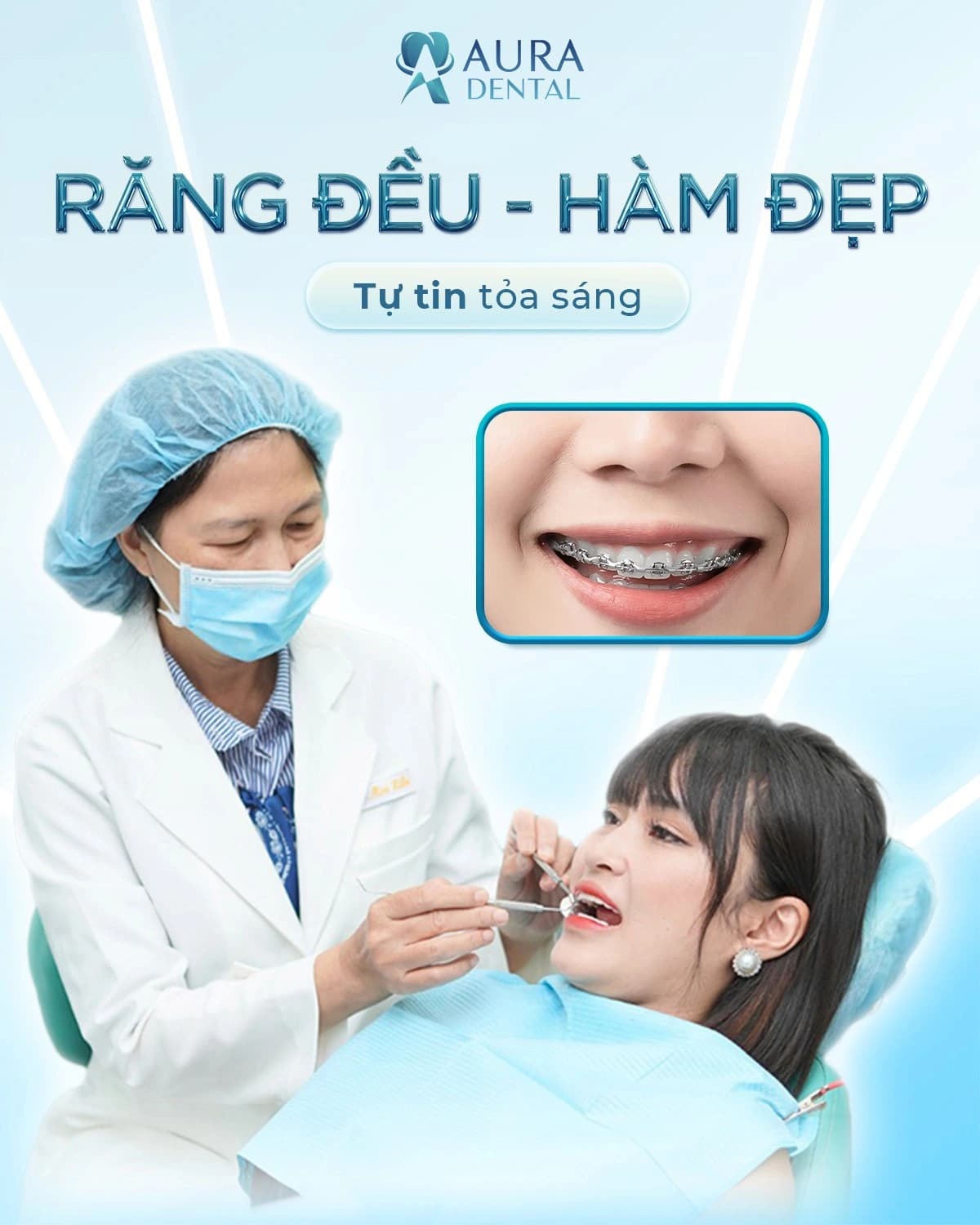 Niềng răng mắc cài