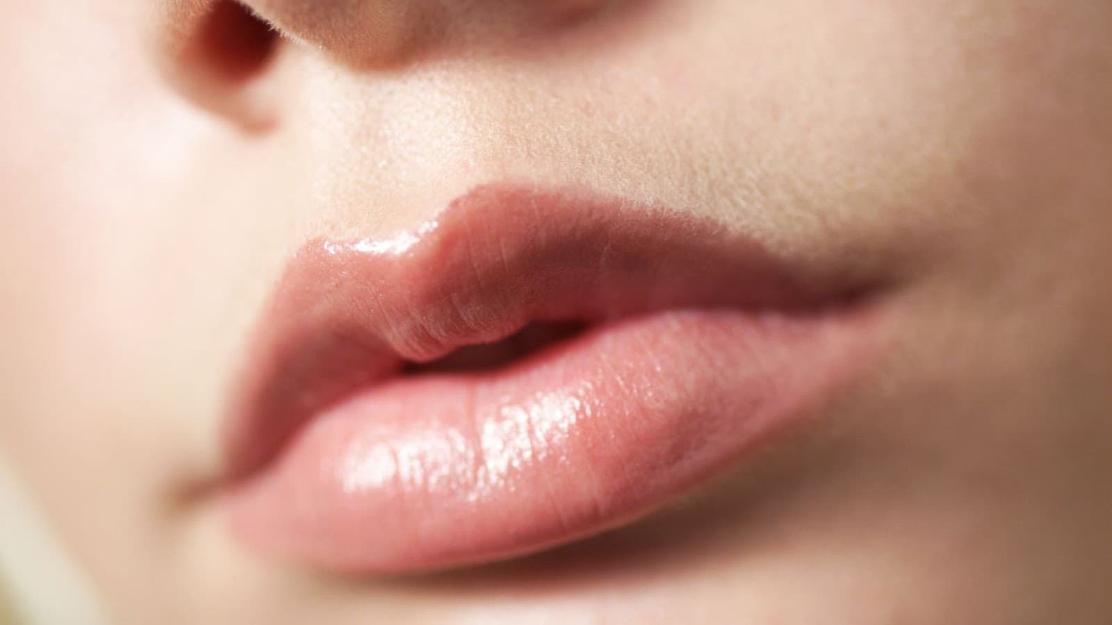 Cắt môi trái tim giá bao nhiêu? Các yếu tố ảnh hưởng
