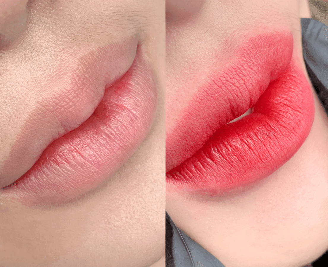 Dịch vụ Phun & Cấy Môi tại Aura Beauty