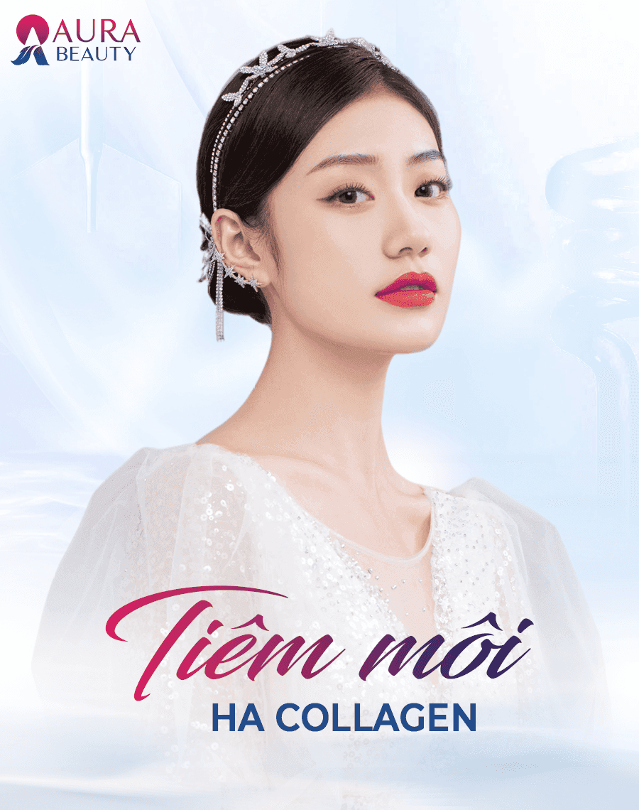 Tiêm Môi HA Collagen