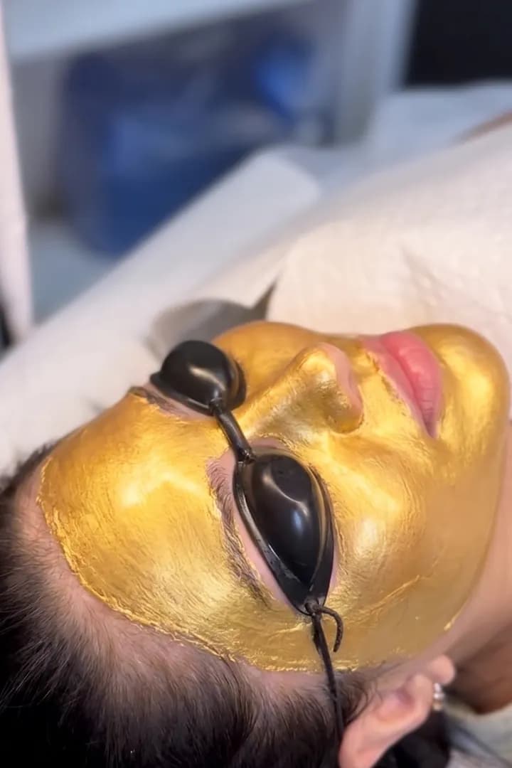 Đắp mặt nạ vàng lá 24K trong quy trình SkinGold Melasma