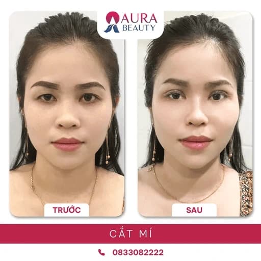 AURA Beauty là một trong những lựa chọn hàng đầu hiện nay