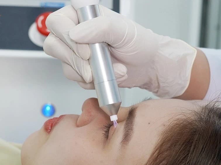 Nhiều công nghệ cắt mí hiện đại giúp giảm đau, hạn chế sưng tấy và rút ngắn thời gian hồi phục