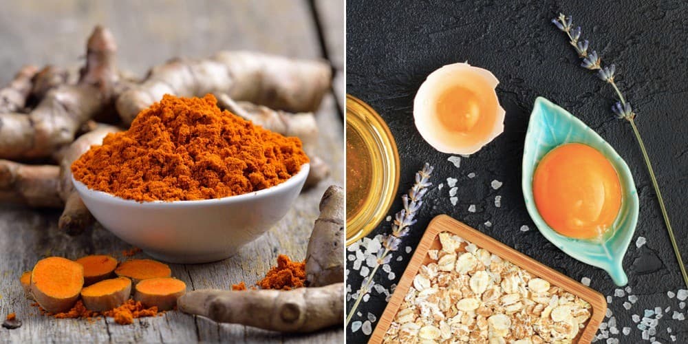 Trị nám hiệu quả tại nhà với bột nghệ và trứng gà