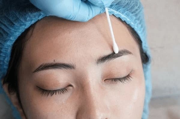 Dung dịch xóa mực là một trong những phương pháp để cải thiện tình trạng chân mày trổ đỏ