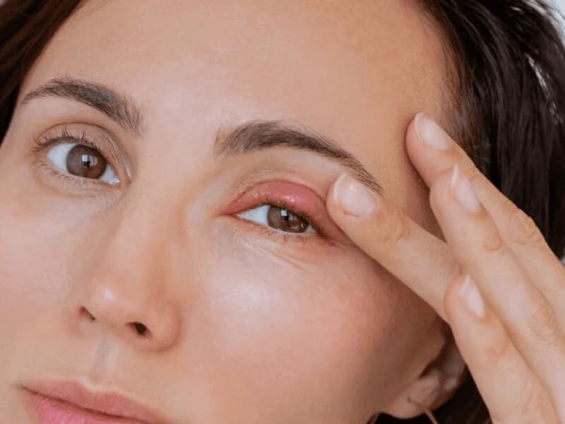 Vệ sinh da mặt một cách an toàn để không ảnh hưởng đến vùng mí