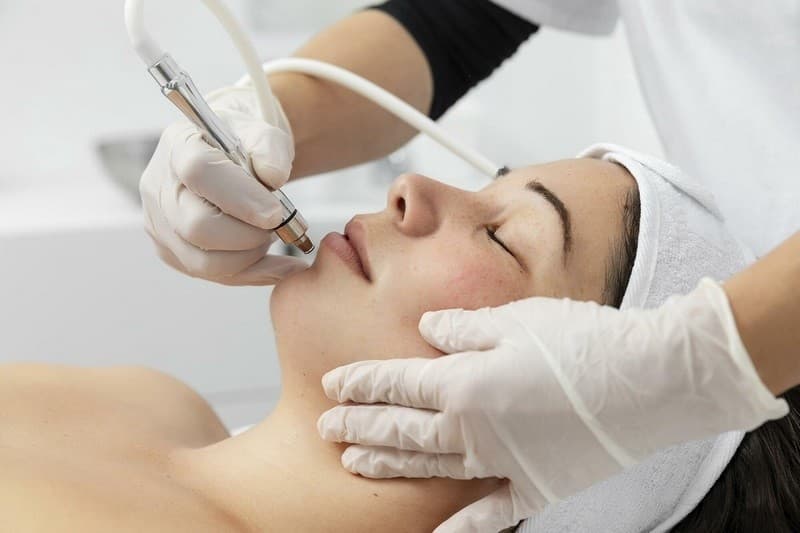 Loại bỏ nám bằng công nghệ cao