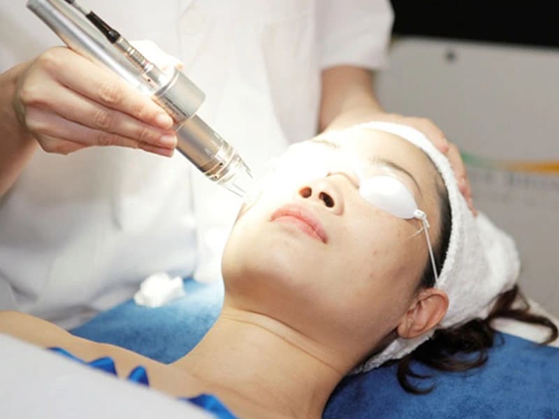 Tìm hiểu các loại nám da: Nguyên nhân và cách điều trị