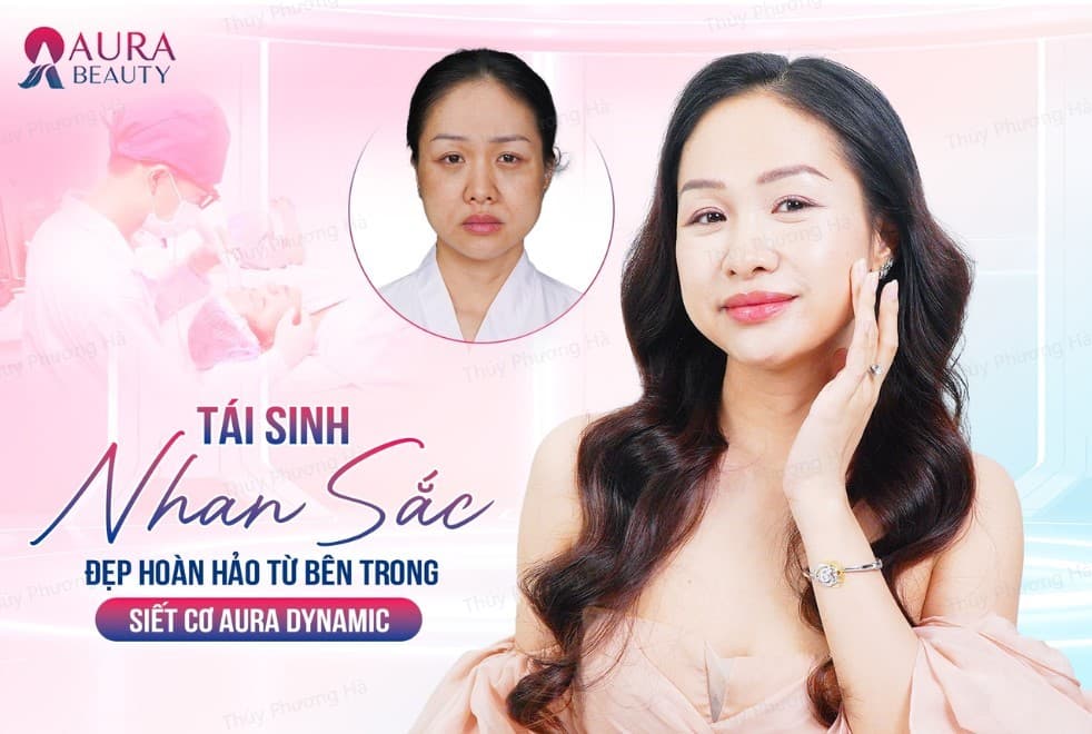 Kỹ thuật siết cơ nội soi Aura Dynamic