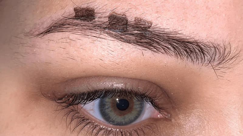Việc ăn uống không kiêng cữ khiến lông mày tự ý bóc vảy và thậm chí trổ đỏ