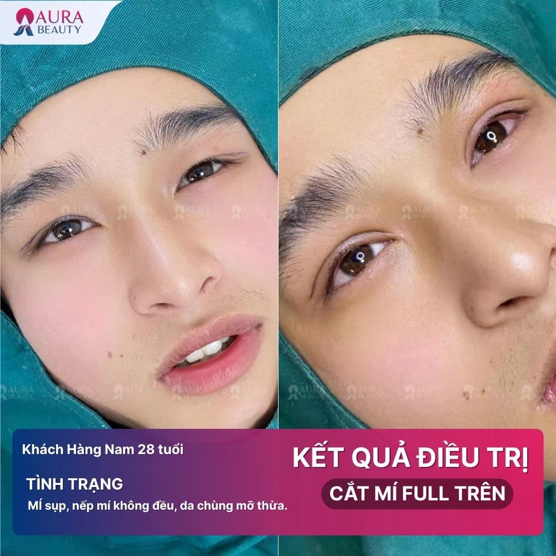 Mỗi địa chỉ thẩm mỹ sẽ có các phương pháp và bác sĩ tay nghề khác nhau