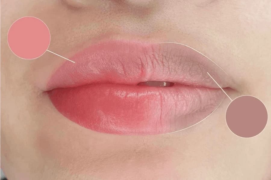 Khử thâm môi là một phương pháp cải thiện thâm môi bẩm sinh
