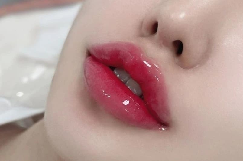 Cấy môi sinh học là gì?