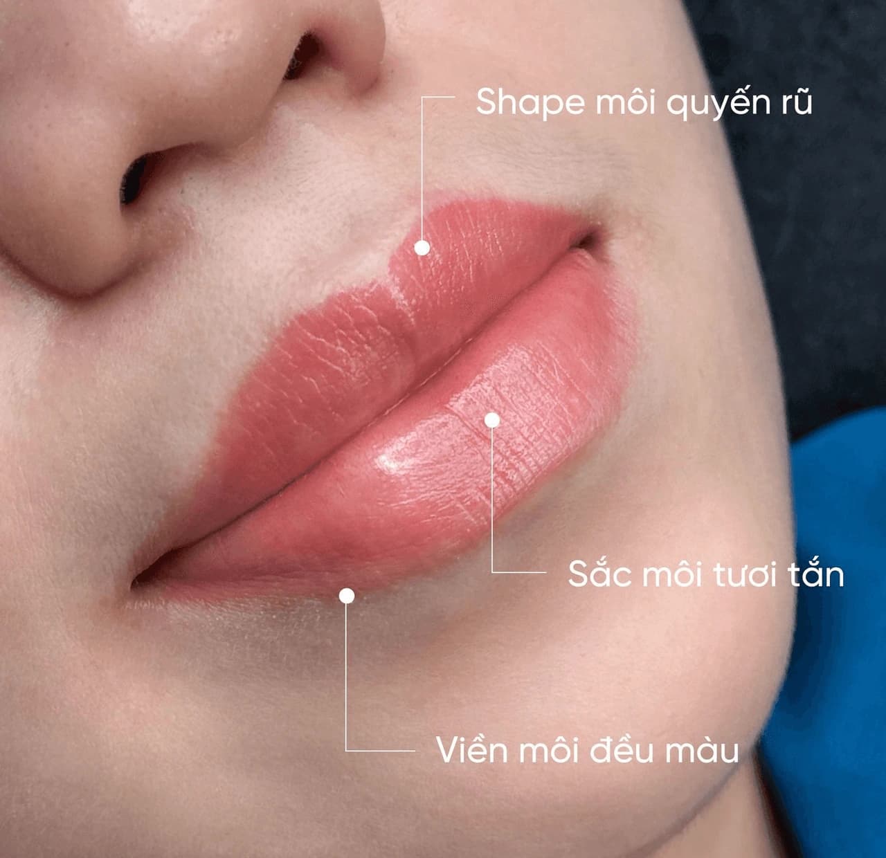 Những ưu điểm khi khử thâm môi tại Aqua Clinic