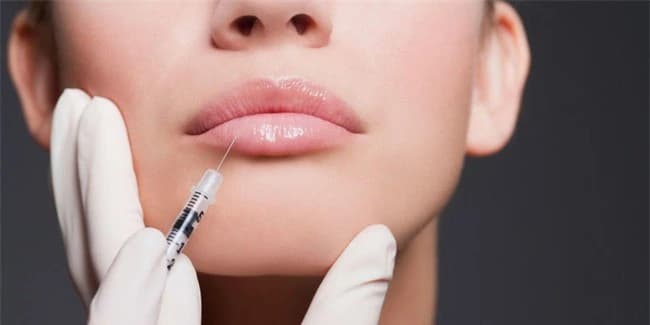 Những ai không nên tiêm filler môi?