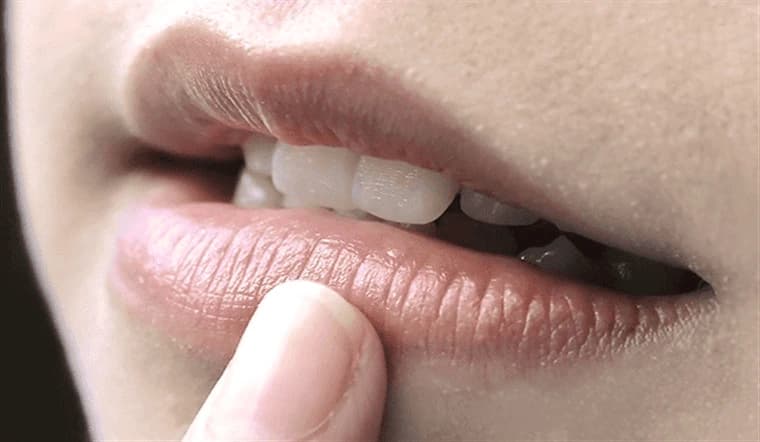 Môi thâm bẩm sinh xuất phát từ nhiều nguyên nhân