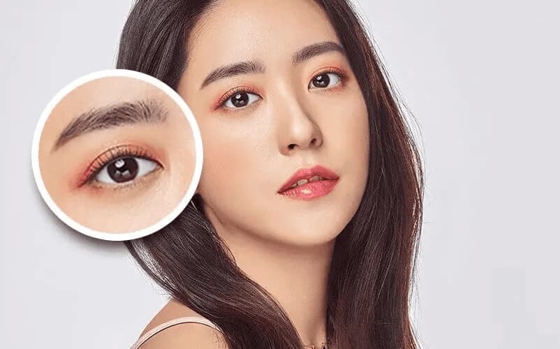Nhấn mí mắt có giá từ 1 triệu đồng trở lên