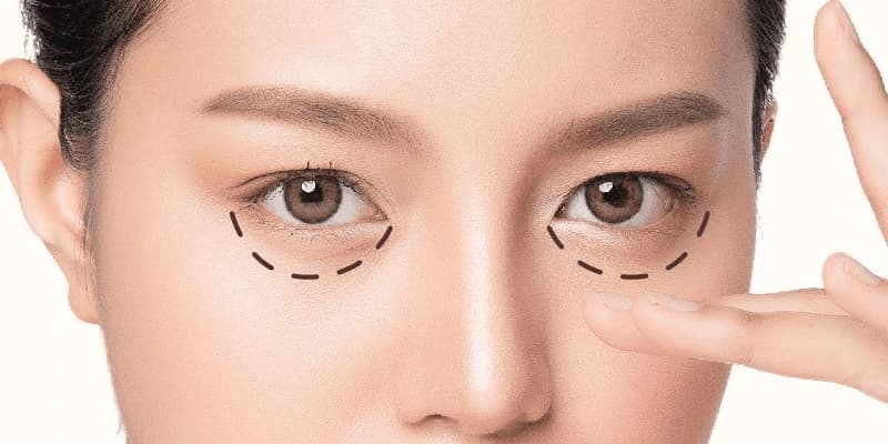 Lựa chọn giải pháp phù hợp để cải thiện gương mặt tươi trẻ, rạng rỡ
