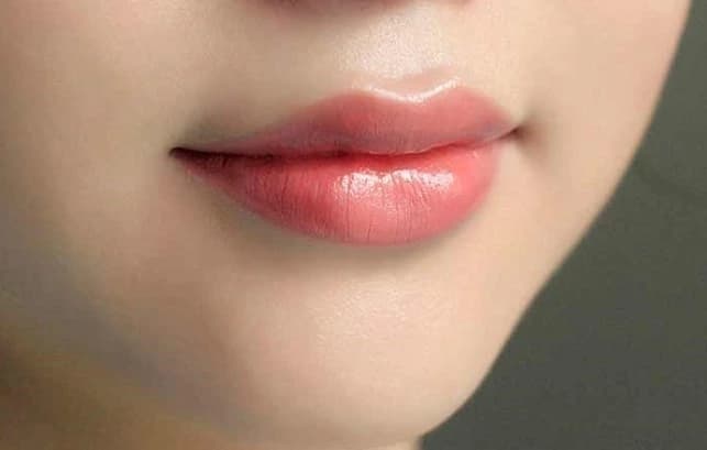 Lợi ích và tác dụng của tiêm filler môi