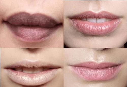 Tình trạng của môi hiện tại