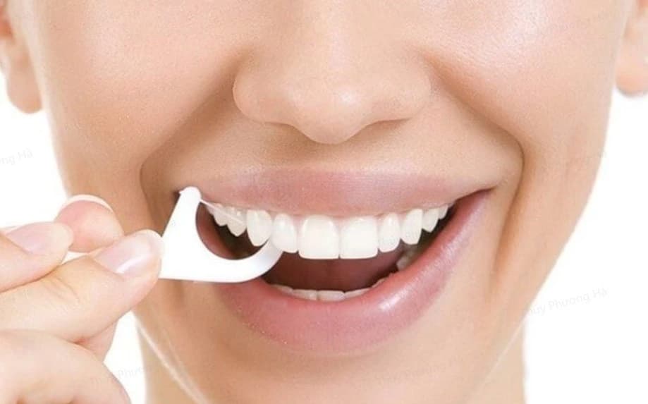 Bạn nên sử dụng chỉ nha khoa để làm sạch mảng bám và thức ăn dính vào các kẽ răng