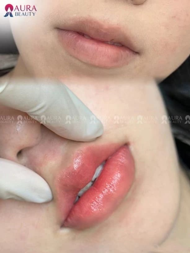 Tuân thủ lời dặn của bác sĩ để có kết quả tốt nhất