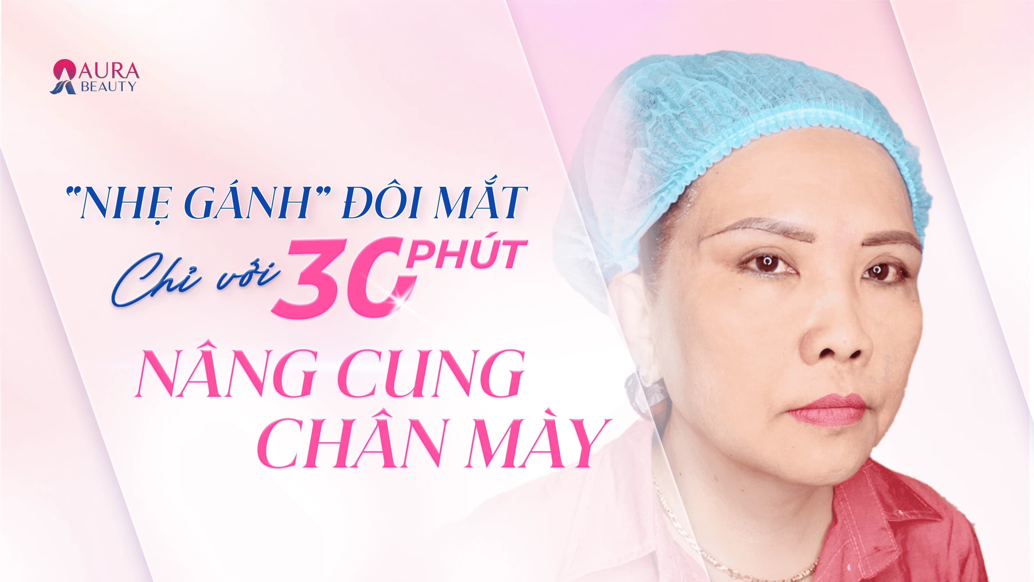 Cắt mí