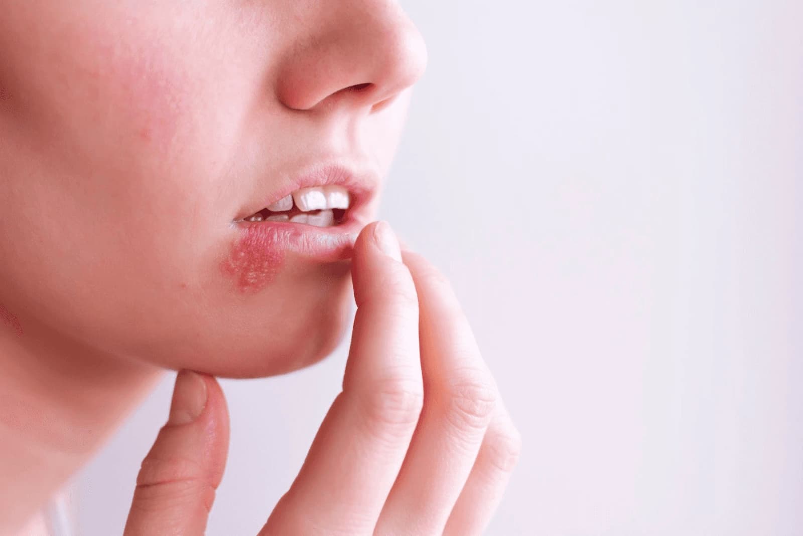 Môi bị sưng đau khó chịu là dấu hiệu mà bạn cần đến gặp bác sĩ phun xăm lập tức