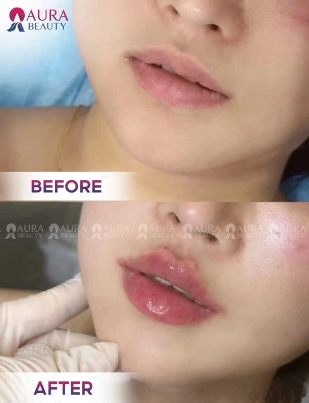 Khách hàng phun môi màu hồng đào tại Aura