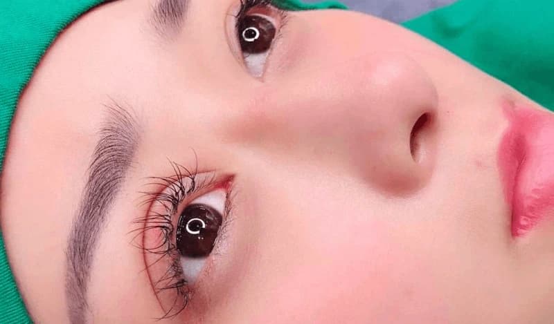 Cắt mí là phương pháp thẩm mỹ giúp đôi mắt lấy lại vẻ tươi trẻ và sắc nét hơn