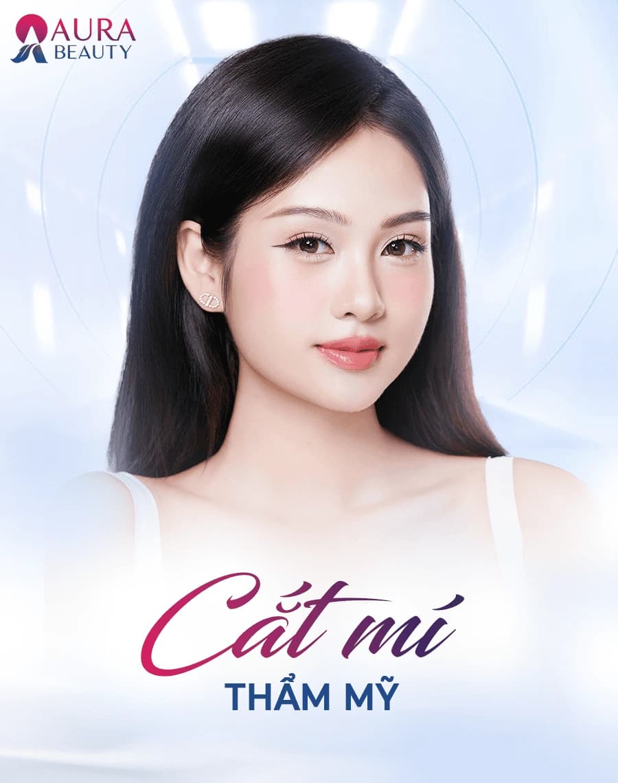 Cắt mí