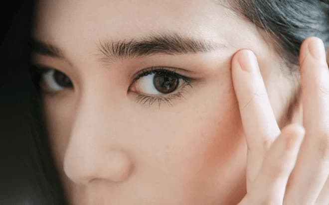 Trong một số trường hợp, cắt mí sau 1 tháng vẫn sưng có thể bắt nguồn từ chính cơ địa của người thực hiện