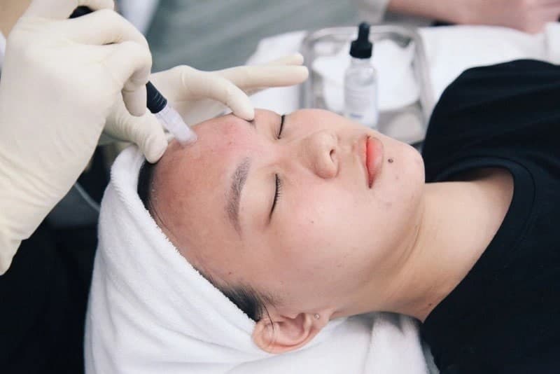 Tiêm meso bao lâu thì đẹp