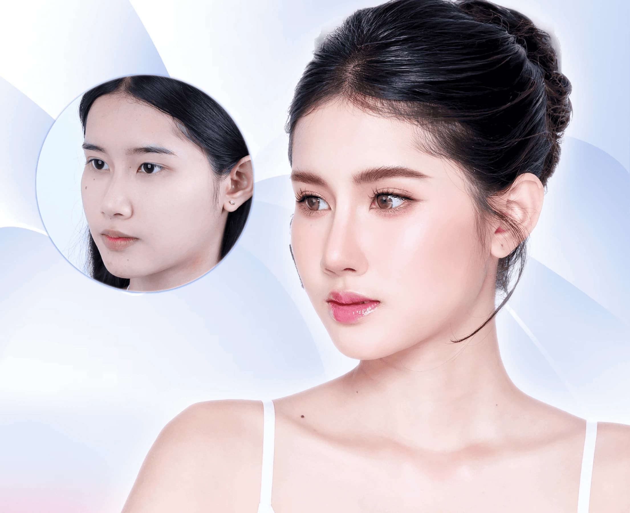 Thẩm mỹ tạo hình mắt