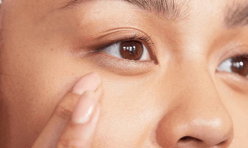 Bọng mắt có đẹp không phụ thuộc vào sự hài hòa với gương mặt