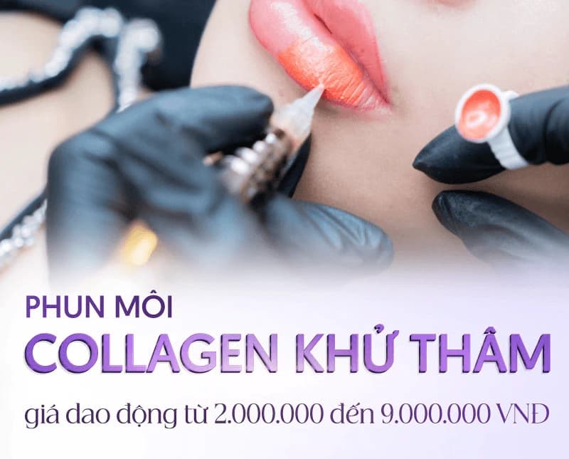 Phun môi khử thâm tại Viện thẩm mỹ Linh Anh