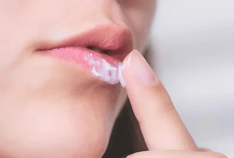 Thoa thuốc mỡ cho môi để hạn chế việc đau rát, kích ứng hay viêm nhiễm