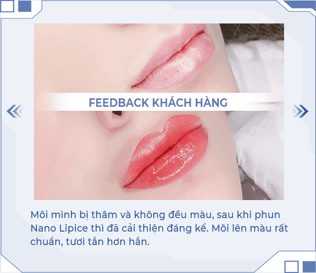 Kết quả phun môi Nano Lipice 2