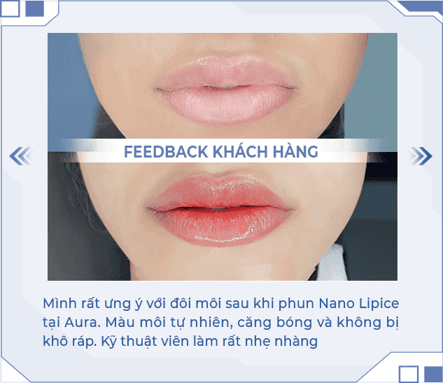 Kết quả phun môi Nano Lipice 1