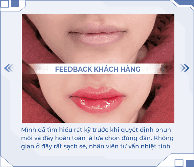 Kết quả phun môi Nano Lipice 3