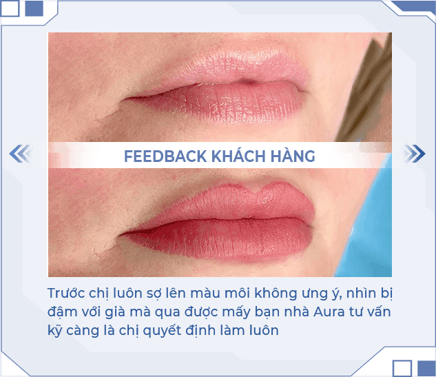 Kết quả phun môi Nano Lipice 4