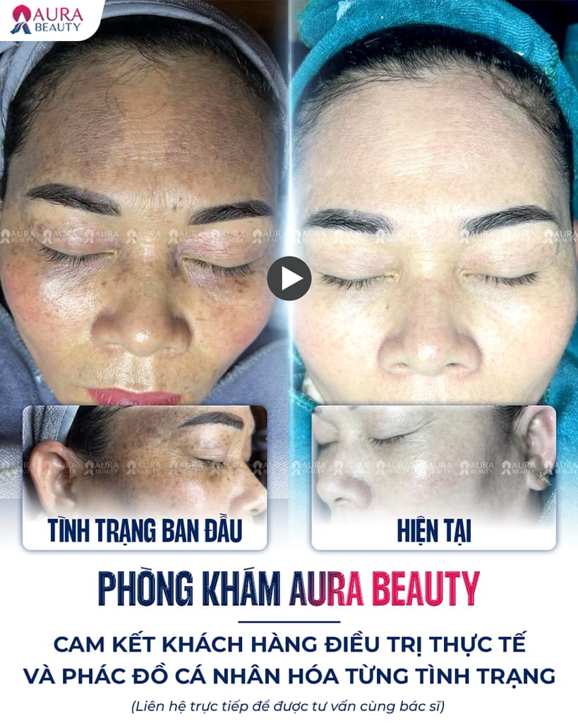 Bác sĩ và chuyên gia Aura Beauty 1