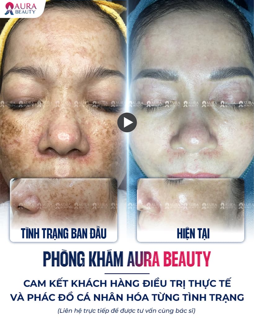 Bác sĩ và chuyên gia Aura Beauty 2