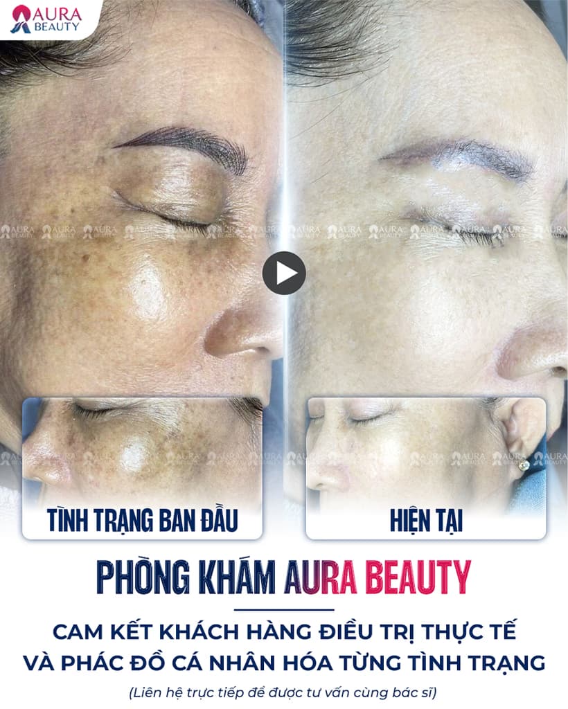 Bác sĩ và chuyên gia Aura Beauty 3