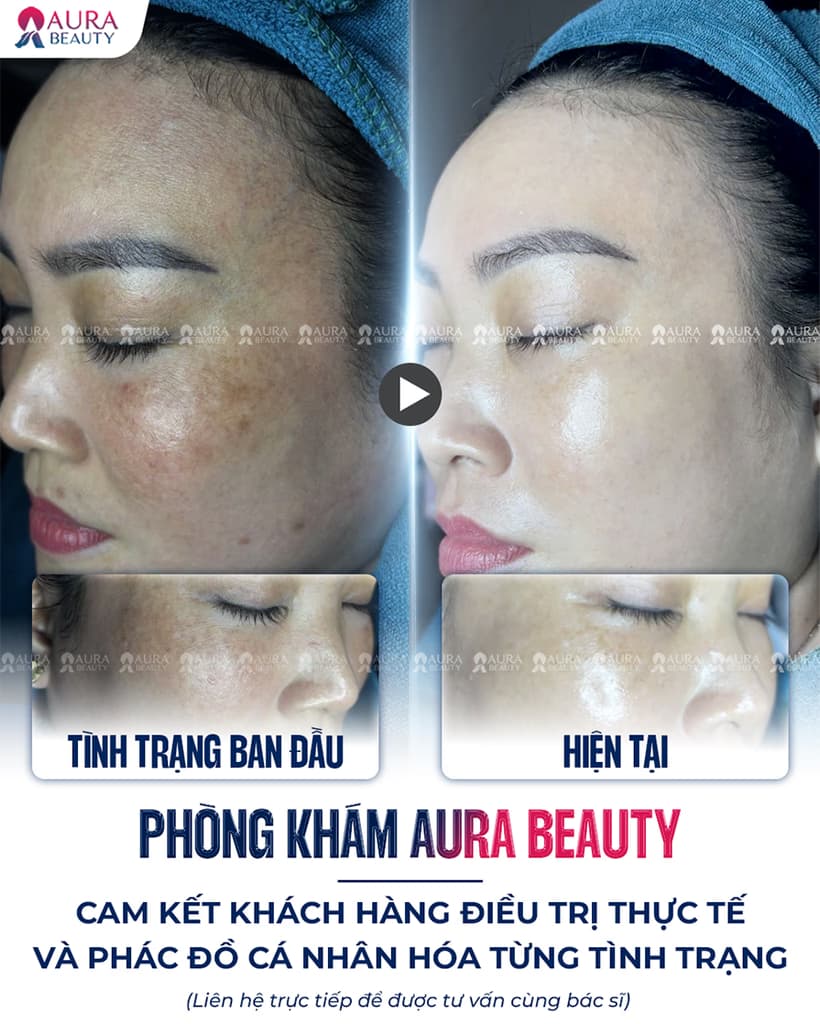 Bác sĩ và chuyên gia Aura Beauty 5