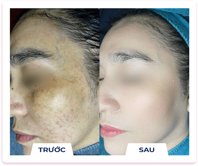 Búp bê mắt đen — Aura Beauty