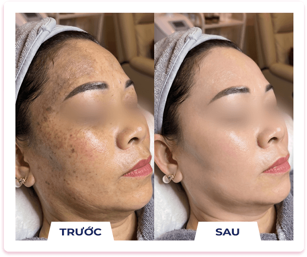 Búp bê mắt đen — Aura Beauty